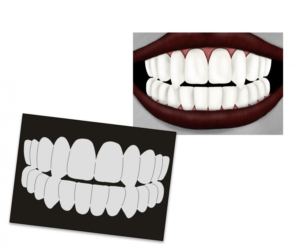 AS-203 Zähne - Smile Singlestep Airbrushschablone Größe M